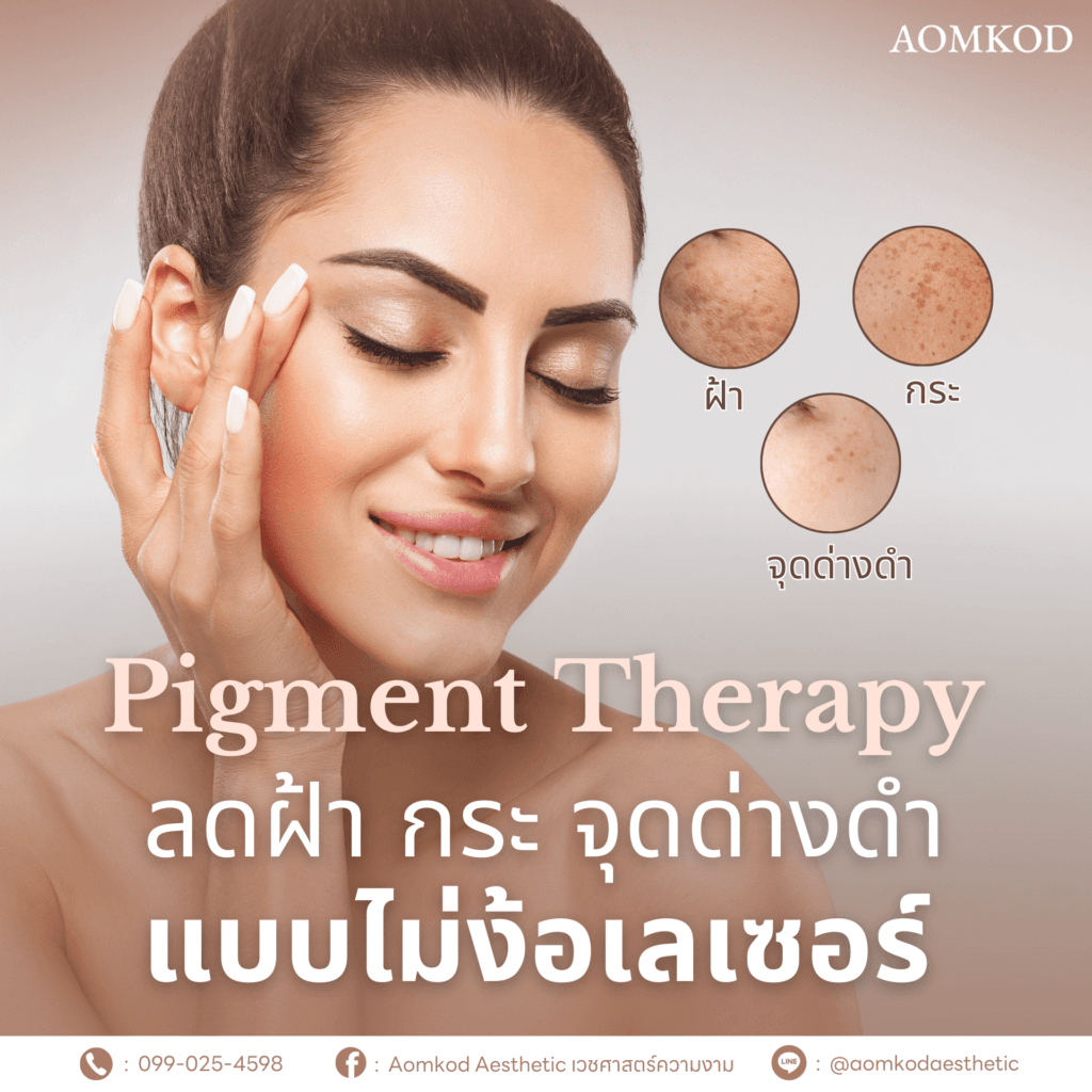 Pigment Therapy…ลดฝ้า กระ จุดด่างดำ แบบไม่ง้อเลเซอร์