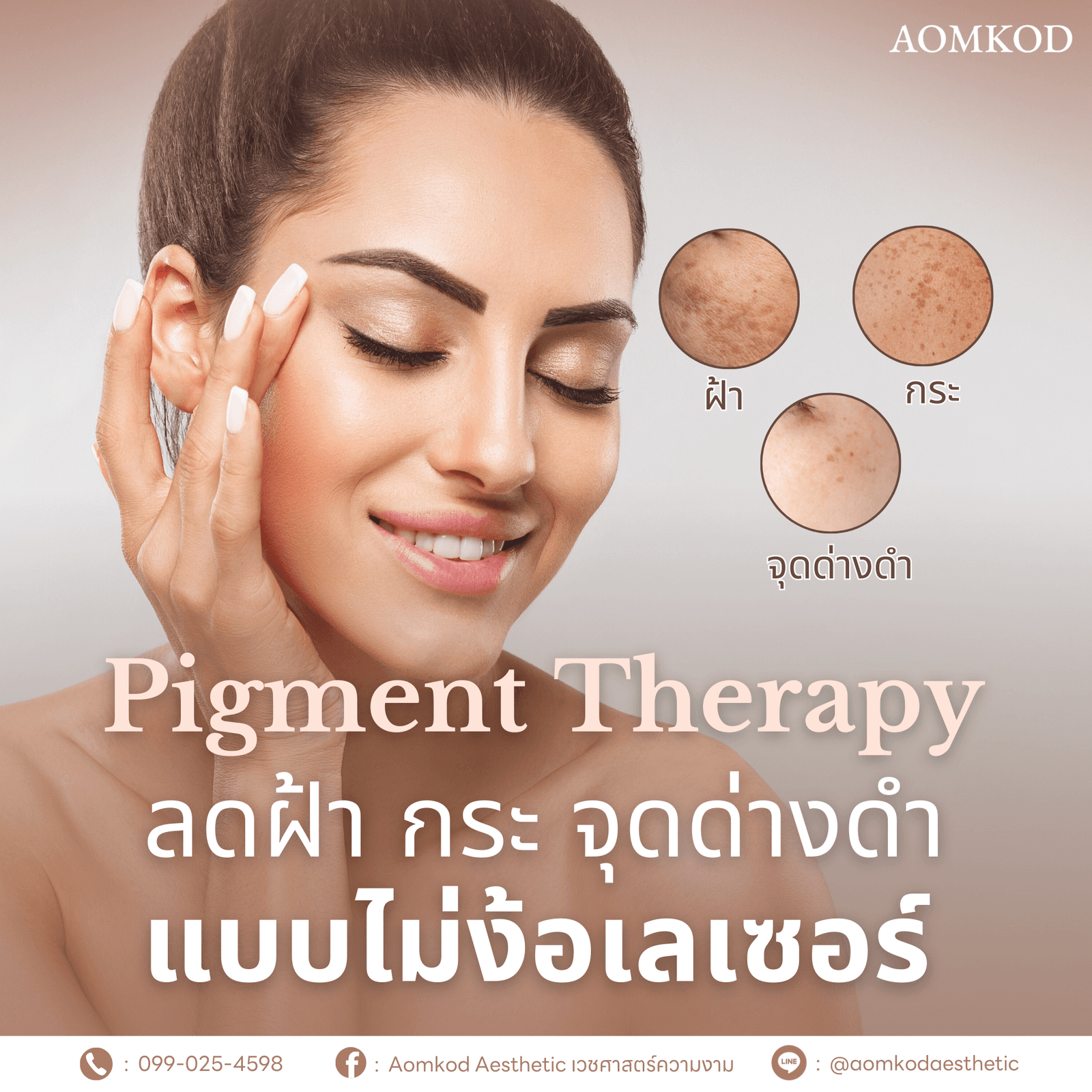 Pigment Therapy…ลดฝ้า กระ จุดด่างดำ แบบไม่ง้อเลเซอร์