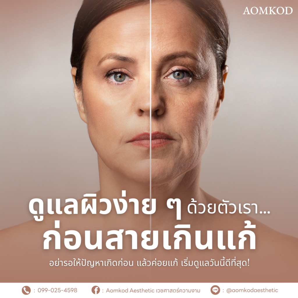 ดูแลผิวง่าย ๆ ด้วยตัวเรา…ก่อนสายเกินแก้