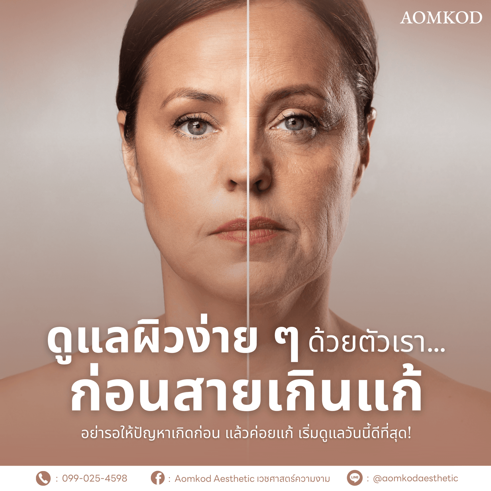ดูแลผิวง่าย ๆ ด้วยตัวเรา…ก่อนสายเกินแก้