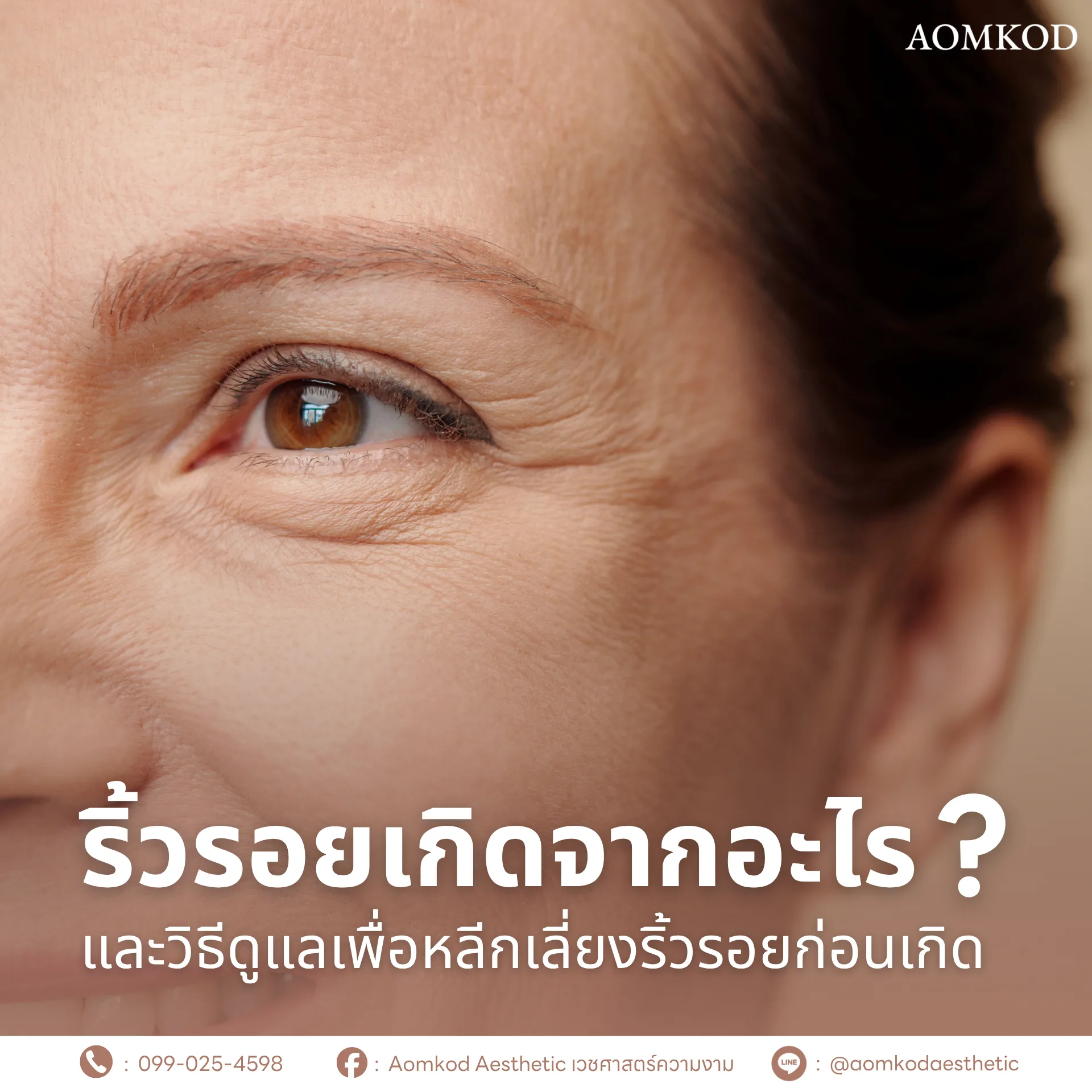 ริ้วรอยเกิดจากอะไร? และวิธีดูแลเพื่อหลีกเลี่ยงริ้วรอยก่อนเกิด